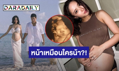 “น้ำชา” อวดภาพอัลตร้าซาวด์ลูกชาย ถามหน้าเหมือนคุณพ่อหรือคุณแม่น้า?!