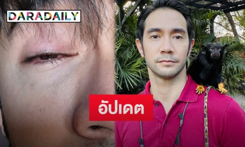 “โพลาร์ ชยพล” เผยถูกลูกลิงตะปบ ส่งผลกระจกตาถลอกหวิดเสียการมองเห็น