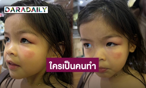 สุดเอ็นดู! “น้องมีญ่า” ลูกสาว “มาร์กี้” หน้าบวมเพราะ??