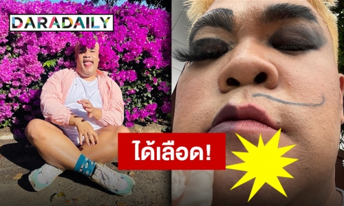 หลังวาเลนไทน์ก็ได้เลือด!! “ปิงปอง” ผิดคิวกลางกอง เฉาะคางแผลบะเร่อ!!