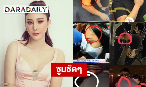 ซูมชัดๆ ภาพบาดแผลบนร่างกายของคนร่วมเรือ “แตงโม”