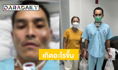 แฟนๆ เป็นห่วง เกิดอะไรขึ้นกับ “สงกรานต์ เตชะณรงค์” ต้องเจาะคอ นอน ICU กว่า 7 วัน