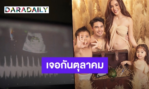 ไม่ต้องลุ้นอีกต่อไป! “ลีเดีย-แมทธิว” ประกาศข่าวดีท้องลูกคนที่ 3 แล้ว