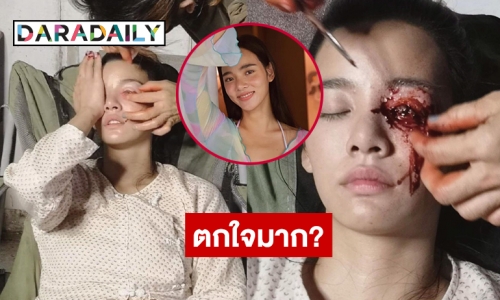 เกือบต้องควักลูกตา “วาววา” ตกใจมาก?