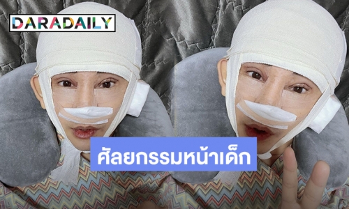 “พชร์ อานนท์” อวดศัลยกรรมรอบใหม่ หน้าเด็กลงไป 20 ปี โนสนคนบูลลี่