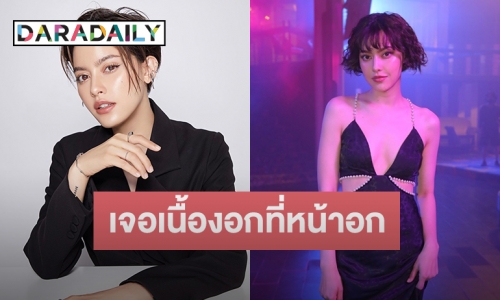 “นิ้ง ชัญญา” สุดสตรอง เจอเนื้องอกที่สมอง-หน้าอก แต่ขอสู้ บอกต้องมูฟออนและยอมรับมัน