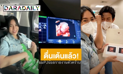 “พุฒ-จุ๋ย” โชว์อัลตร้าซาวด์ “PJน้อย” คุณพ่อคุณแม่ป้ายแดงตื่นเต้นสุดๆ