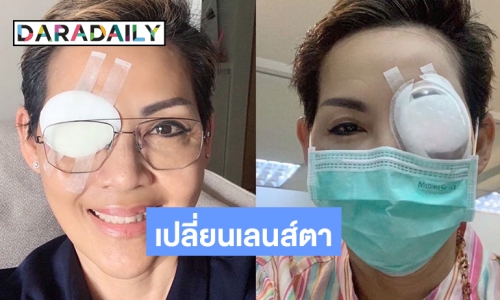 ประสบการณ์ระทึก “เชฟป้อม” เปลี่ยนเลนส์ตา เหตุเลสิคประกันไม่จ่าย?