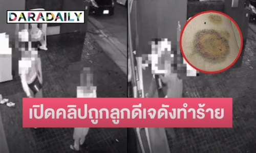 เปิดหลักฐาน กรณี “ลูกดีเจดัง” ทำร้าย “ไฮโซสาว” ที่ฝั่งพี่ชายก็เพิ่งต่อยคนฟันร่วง