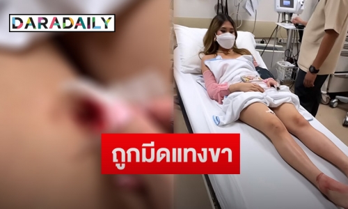 “มิย่า” ลูก “พีท ทองเจือ” ซนจนได้เลือด ถูกมีดแทงขา