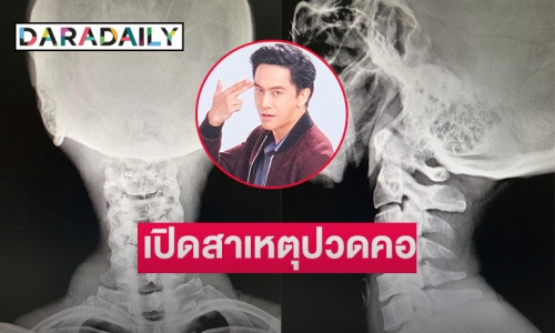 แฟนๆ ส่งกำลังใจ “จอร์จ ฐปนัท” ต้องพักยาวเพราะเหตุนี้