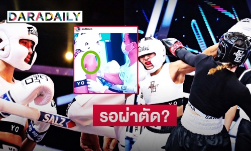  “โย” ขอโทษทุกคนคาดไหล่หลุดรอผ่าตัด