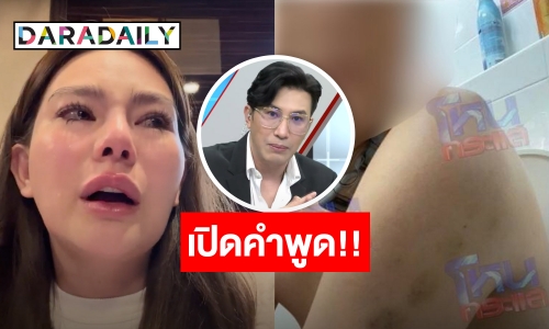 เปิดคำพูด! “ดิว อริสรา” หลังออกมาแฉถูกแฟนเก่าทำร้ายร่างกาย