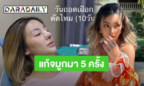 “ฮารุ สุประกอบ” แก้จมูกใหม่รอบที่ 5 พอหน้าเข้าที่แล้วสวยพุ่งมากแม่