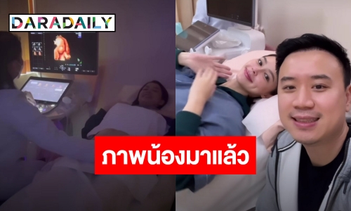 เปิดโฉมหน้าทายาทคนแรก “แพทริเซีย-โน้ต วิเศษ”