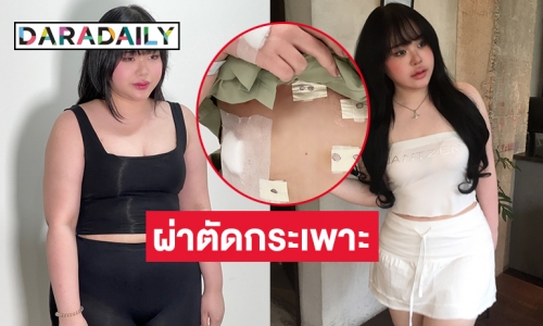 “เน็ตไอดอล”  รีวิวพลีชีพผ่าตัดกระเพาะ จาก 86 เหลือ 68 ในสามเดือน 