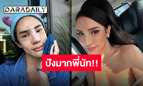 “นิสามณี” รีวิวอย่างเริ่ด ความเจ็บปวดแลกความสวยงาม ดั้งใหม่ปังจริง!!