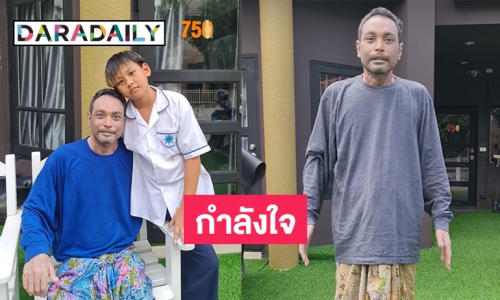 “วินัย ไกรบุตร”  ลงคลิปอัปเดตอาการล่าสุดยังไหวแม้มีแผลตามผิวเพิ่มมากขึ้น 