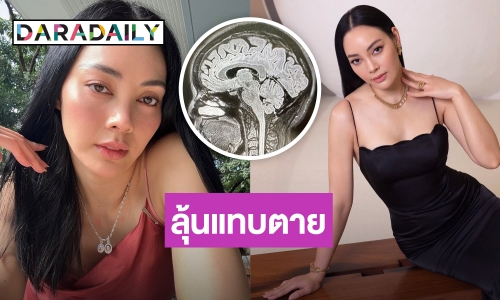 ลุ้นแทบตาย! “ตั๊ก บงกช” เปิดภาพ MRI สมอง สาเหตุทำปวดหัวหนัก