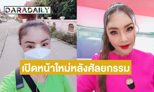 เปิดหน้าใหม่ “ดาว มยุรี” หลังศัลยกรรมจมูกใหม่ในรอบ 20 ปี