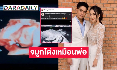 “ธัญญ์ ธนากร” เห็นหน้าลูกแล้ว “ยุ้ย” มาแซว จมูกโด่งเหมือนพ่อเลย