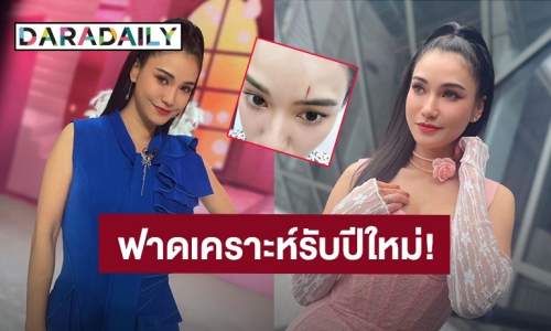 ฟาดเคราะห์รับปีใหม่! “ชมพู่ ธัณย์สิตา” เจ็บจี๊ดนึกว่าหัวโน ที่ไหนได้หัวแตกเลือดออก