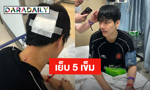 สงกรานต์วันแรก! “นิกกี้ ณฉัตร” ส่งโรงพยาบาลทำแผลเย็บ 5 เข็ม