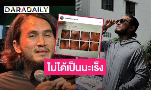 นักร้องหนุ่มแชร์ประสบการณ์อาการท้องอืด โล่งใจไม่ได้เป็นมะเร็ง