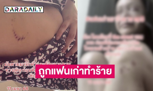 นางเอก MV เพลงดัง แฉโดนแฟนเก่า ลูกอดีตตำรวจใหญ่ทำร้ายร่างกาย