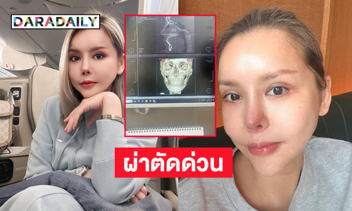 จมูกติดเชื้อพีดีคนดังต้องผ่าตัดด่วน