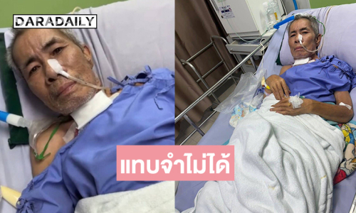 น่าตกใจตลกดังป่วยหนักเห็นภาพแทบจำไม่ได้