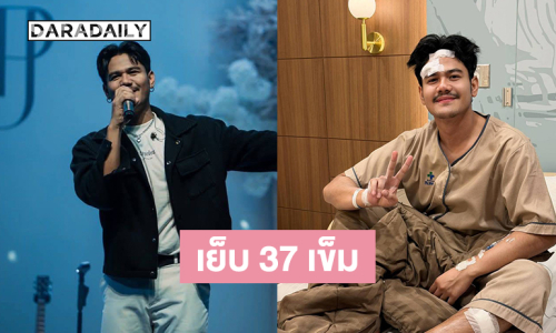 นักร้องดังเดินชนกระจกต้องเย็บ 37 เข็ม