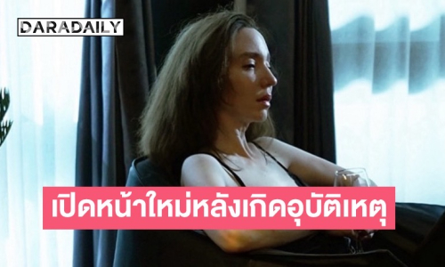 “คลาวเดียร์” เปิดหน้าใหม่ หลังหน้าฟาดพื้นเย็บเกือบ 40 เข็ม จมูกหักจนต้องทำใหม่