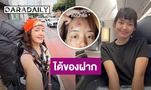 ยูทูบเบอร์ดัง ประสบอุบัติเหตุล้มหน้ากระแทกพื้น