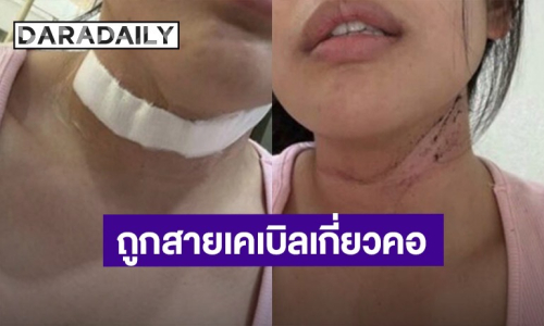 นางงามคนดังเล่านาทีชีวิต ถูกสายเคเบิลเกี่ยวคอหวิดขาด 