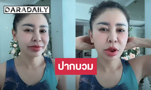 “เป็กกี้ ศรีธัญญา” ปากบวมเป่ง พร้อมเผยสาเหตุ!!