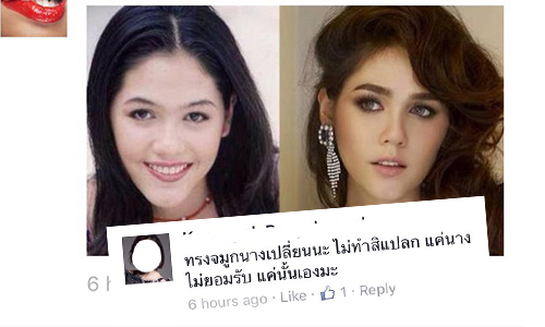 จริงหรือมั่ว? “ชมพู่” ถูกชาวเน็ตจับผิดรอยแผลจากการศัลยกรรมจมูก