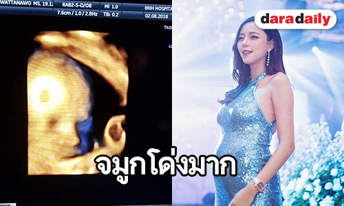 “นิวเคลียร์” เผยภาพอัลตราซาวนด์ลูกชาย “น้องไทก้า” หลังครบ 28 สัปดาห์