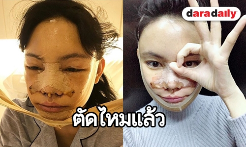 ส่องหน้า “เอมมี่ แม็กซิม” โครง “แม่ชม” มาหรือยัง?