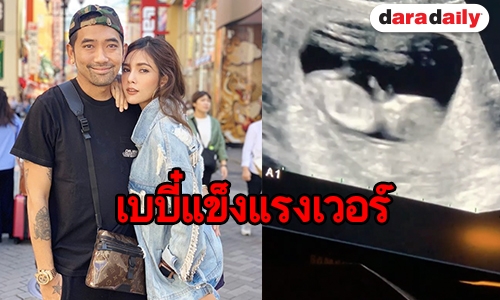 ดิ้นแรงมาก! “คุณแม่อุ้ม” โชว์คลิปอัลตราซาวนด์