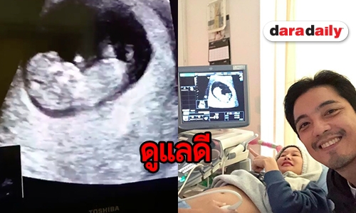 เช็กความพร้อม “พ่อหนุ่ม-แม่ติ๊ก”