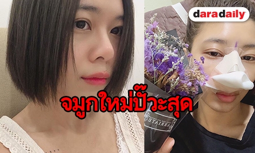เป๊ะปัง! ดั้งใหม่ “แม่กิ๊บ” เกาหลีเวอร์ๆ