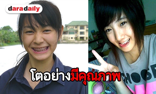 เน็ตไอดอลในตำนาน ใครเป็นใครจำได้ไหมเอ่ย