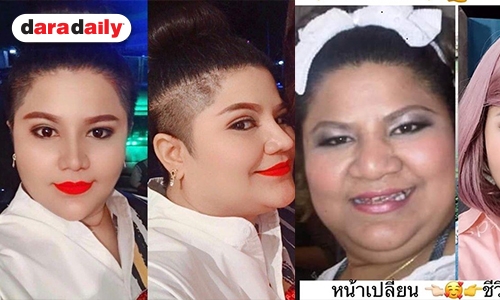 "เห็ดเผาะ" รับเสพติดศัลยกรรม ทำแล้วดูดี