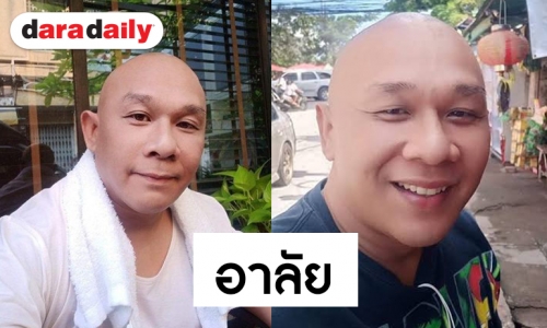สุดเศร้า “โหน่งน้อย” จากไปด้วยโรคตับ