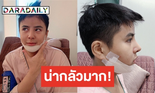 ศัลยกรรมทำพิษ! “นัท มาลิสา” หวิดจบอาชีพศิลปินเพราะฟิลเลอร์ปลอม