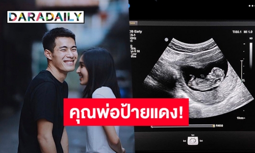 ต้อนรับสมาชิกใหม่ “สารัช อยู่เย็น” เผยภาพอัลตราซาวน์ลูกคนแรก! 