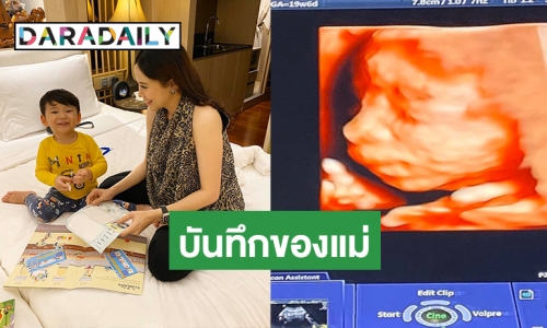 “แยม ธมลพรรณ์” โพสต์ภาพอัลตราซาวด์ เบบี๋คนต่อไปใกล้คลอดแล้ว!