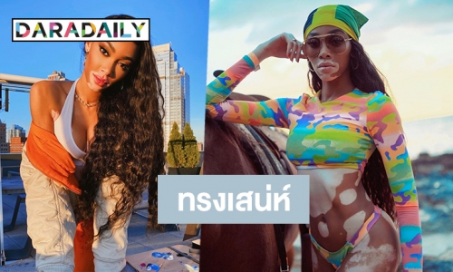 ส่องความเซ็กซี่ Winnie Harlow นางแบบด่างขาวที่มีผู้ติดตาม 7 ล้าน