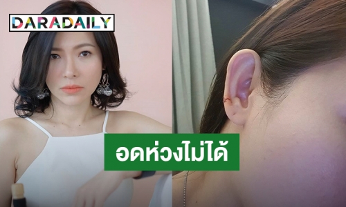 "ดีเจต้นหอม" เผยวินาทีโดนน้องหมากัดที่ใบหู ชาวเน็ตแนะควรไปฉีดยา